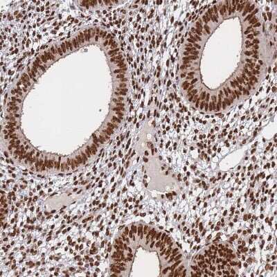 Immunohistochemistry-Paraffin: DNA-PKcs Antibody [NBP2-33995]