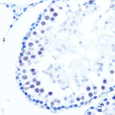 Immunohistochemistry-Paraffin: DNA Polymerase beta Antibody (6M8I5) [NBP3-16127]