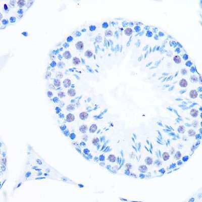 Immunohistochemistry-Paraffin: DNA Polymerase beta Antibody (6M8I5) [NBP3-16127]