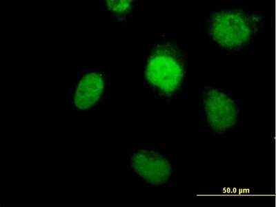 Immunocytochemistry/ Immunofluorescence: DNA Polymerase beta Antibody [H00005423-B01P]