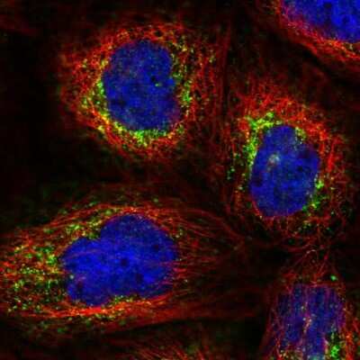Immunocytochemistry/ Immunofluorescence: DNA Polymerase beta Antibody [NBP2-38600]