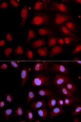 Immunocytochemistry/ Immunofluorescence: DNA Polymerase beta Antibody - BSA Free [NBP3-03454]