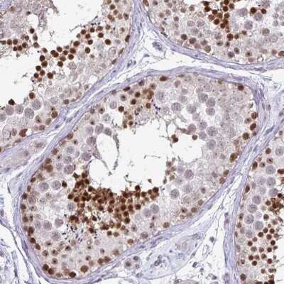 Immunohistochemistry: DNA Polymerase beta Antibody [NBP2-38600]