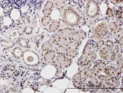 Immunohistochemistry-Paraffin: DNA Polymerase beta Antibody [H00005423-B01P]
