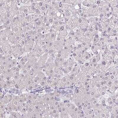 Immunohistochemistry-Paraffin: DNA Polymerase beta Antibody [NBP2-38600]