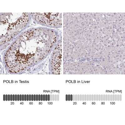 Immunohistochemistry-Paraffin: DNA Polymerase beta Antibody [NBP2-38600]