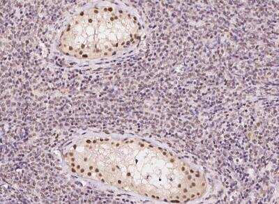 Immunohistochemistry-Paraffin: DNA Polymerase beta Antibody [NBP3-05939]