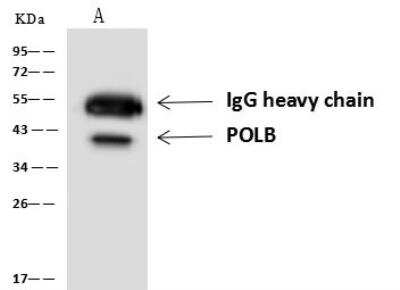 Immunoprecipitation: DNA Polymerase beta Antibody [NBP3-05939]
