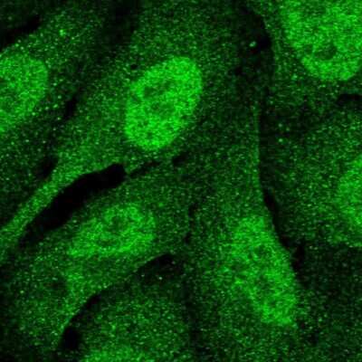 Immunocytochemistry/ Immunofluorescence: DNA Polymerase delta, catalytic subunit Antibody [NBP2-33466]
