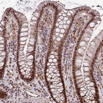 Immunohistochemistry-Paraffin: DNA Polymerase delta, catalytic subunit Antibody [NBP2-33466]