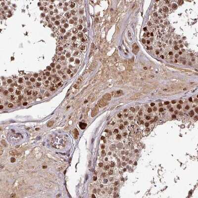 Immunohistochemistry-Paraffin: DNA Polymerase delta, catalytic subunit Antibody [NBP2-33466]