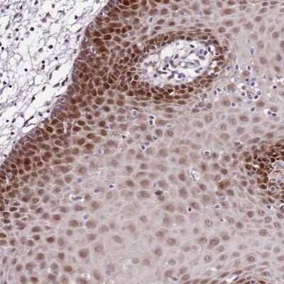Immunohistochemistry-Paraffin: DNA Polymerase epsilon subunit 3 Antibody [NBP2-13785]