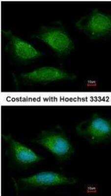 Immunocytochemistry/ Immunofluorescence: DNA Polymerase gamma Antibody [NBP1-33633]