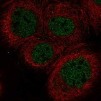 Immunocytochemistry/ Immunofluorescence: DNA Polymerase lambda Antibody [NBP3-17833]
