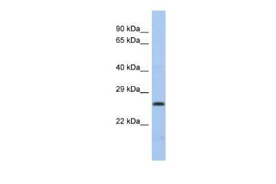 Western Blot: DNA Polymerase lambda Antibody [NBP2-88804]
