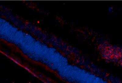 Immunocytochemistry/ Immunofluorescence: DNA/RNA Damage Antibody (15A3) [NB110-96878]