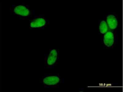Immunocytochemistry/ Immunofluorescence: DNA polymerase delta p50 Antibody [H00005425-B01P]