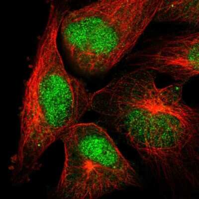 Immunocytochemistry/ Immunofluorescence: DNA polymerase mu Antibody [NBP2-57664]