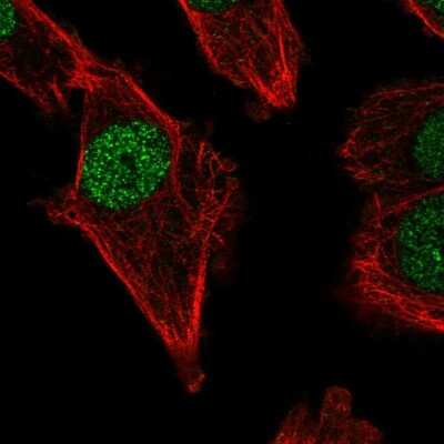 Immunocytochemistry/ Immunofluorescence: DNA polymerase mu Antibody [NBP2-58506]