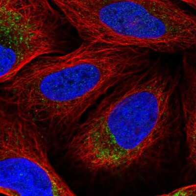 Immunocytochemistry/ Immunofluorescence: DNA2 Antibody [NBP2-57190]