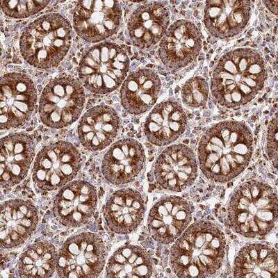 Immunohistochemistry-Paraffin: DNA2 Antibody [NBP1-85006]