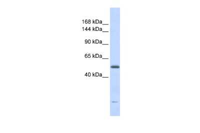 Western Blot: DNA2 Antibody [NBP2-84799]