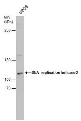 Western Blot: DNA2 Antibody [NBP3-12942]