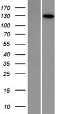Western Blot: DNA2 Overexpression Lysate [NBP2-08334]