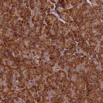 Immunohistochemistry-Paraffin: DNAH10 Antibody [NBP1-81898]