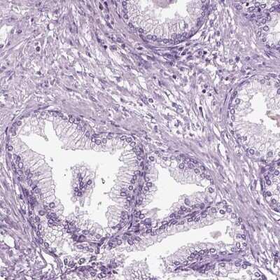 Immunohistochemistry-Paraffin: DNAH10 Antibody [NBP1-81898]