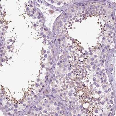 Immunohistochemistry-Paraffin: DNAH10 Antibody [NBP1-81898]