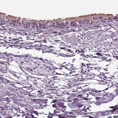 Immunohistochemistry-Paraffin: DNAH10 Antibody [NBP1-81898]