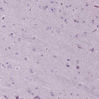 Immunohistochemistry-Paraffin: DNAH10 Antibody [NBP1-81898]