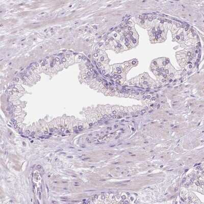 Immunohistochemistry-Paraffin: DNAH12 Antibody [NBP1-90586]