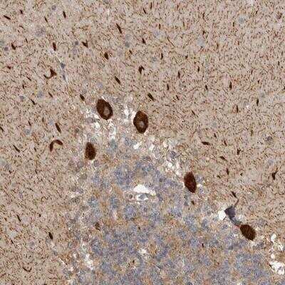 Immunohistochemistry-Paraffin: DNAH14 Antibody [NBP1-88327]