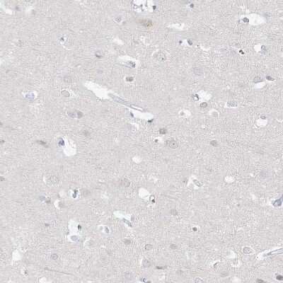 Immunohistochemistry-Paraffin: DNAH5 Antibody [NBP1-84463]