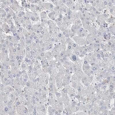 Immunohistochemistry-Paraffin: DNAH5 Antibody [NBP1-84464]