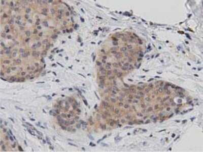 Immunohistochemistry: DNAJA2 Antibody (OTI3A10) - Azide and BSA Free [NBP2-71565]