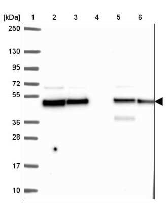 Western Blot: DNAJA2 Antibody [NBP2-32551]