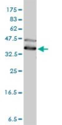 Western Blot: DNAJA4 Antibody (4B4-1F2) [H00055466-M01]