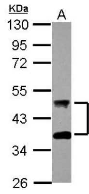Western Blot: DNAJA4 Antibody [NBP2-14931]
