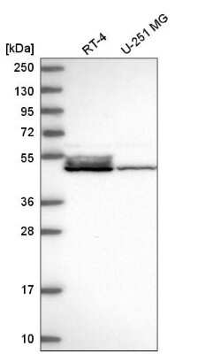 Western Blot: DNAJA4 Antibody [NBP2-58975]