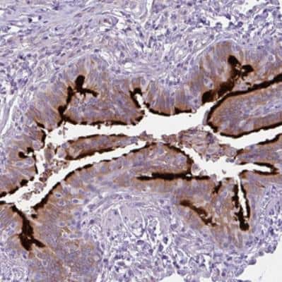 Immunohistochemistry: DNAJB13 Antibody [NBP2-30620]