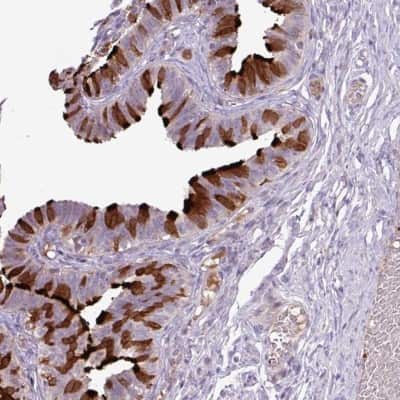 Immunohistochemistry-Paraffin: DNAJB13 Antibody [NBP2-30620]