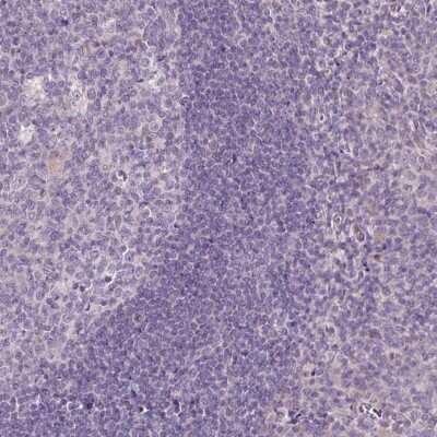 Immunohistochemistry-Paraffin: DNAJB13 Antibody [NBP2-30620]