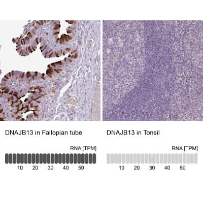 Immunohistochemistry-Paraffin: DNAJB13 Antibody [NBP2-30620]