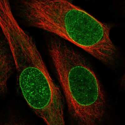 Immunocytochemistry/ Immunofluorescence: DNAJB2 Antibody [NBP1-83188]