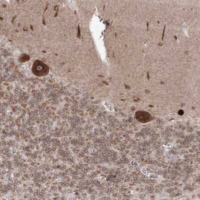 Immunohistochemistry-Paraffin: DNAJB2 Antibody [NBP1-83188]