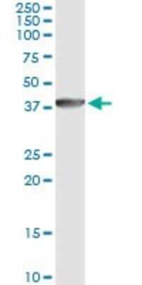 Immunoprecipitation: DNAJB6 Antibody (1A5) [H00010049-M03]