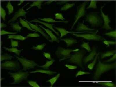 Immunocytochemistry/ Immunofluorescence: DNAJB6 Antibody (2D12-B9) [H00010049-M02]